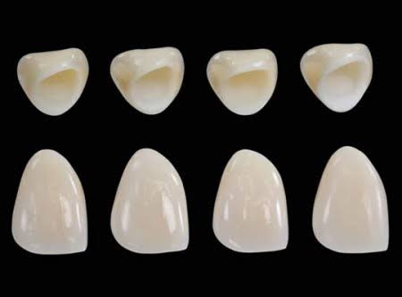 Bọc răng sứ Zirconia